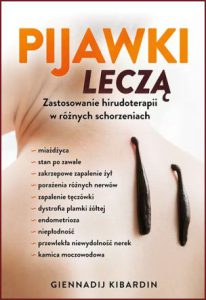 PIJAWKI LECZĄ Zastosowanie hirudoterapii w różnych schorzeniach
